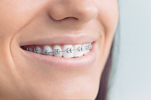 Best Traditional Braces  in Briarcliff Manor, NY